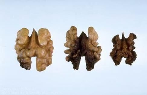 Potasyum Sülfat DRT (25 Kg )